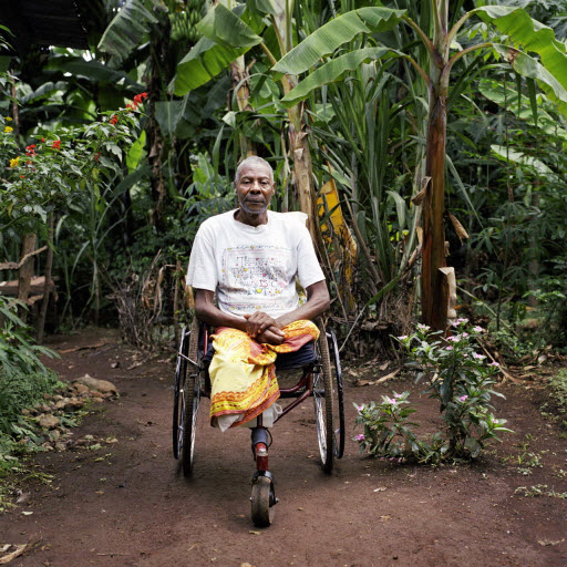 Disability_amputation_WHO_019013_tanzania Disability and amputation in Tanzania