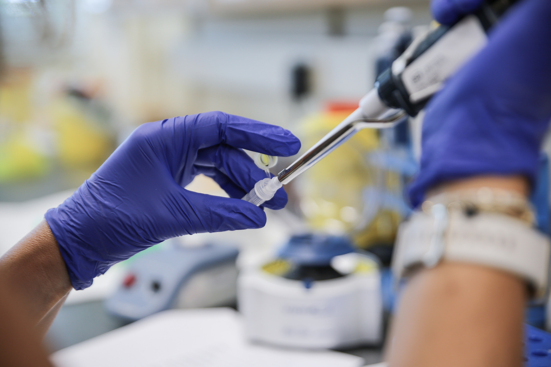 Mpox samples for PCR diagnosis A laboratory technician prepares the samples of the monkeypox for PCR diagnosis