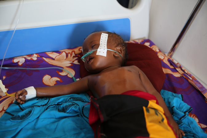 An infant battling pneumonia in De-Martini hospital, Somalia.