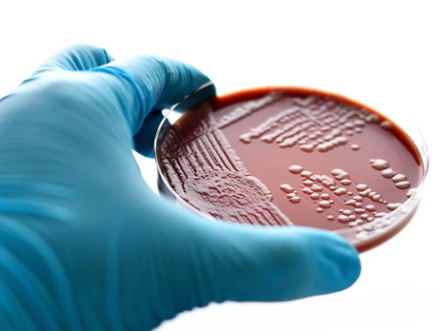 Addressing antimicrobial resistance in STIs
