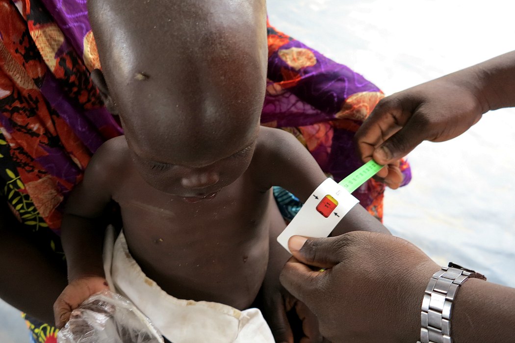 A young child in Muna Garage camp for internally displaced people (IDP) in Borno State is screened for malnutrition, Nigeria 2016.