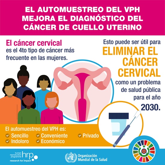 Infografía : El automuestreo del VPH mejora el diagnóstico del cáncer de cuello uterino.