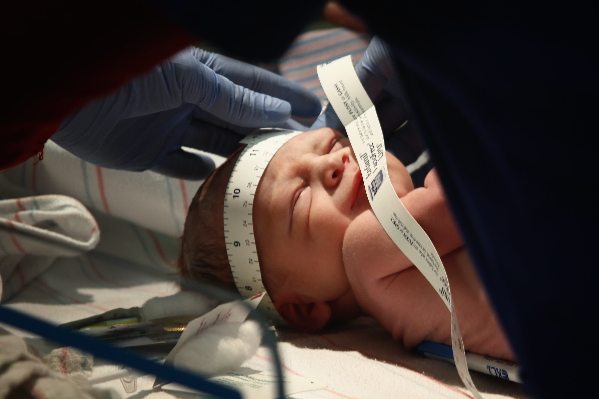Baby's head measurement