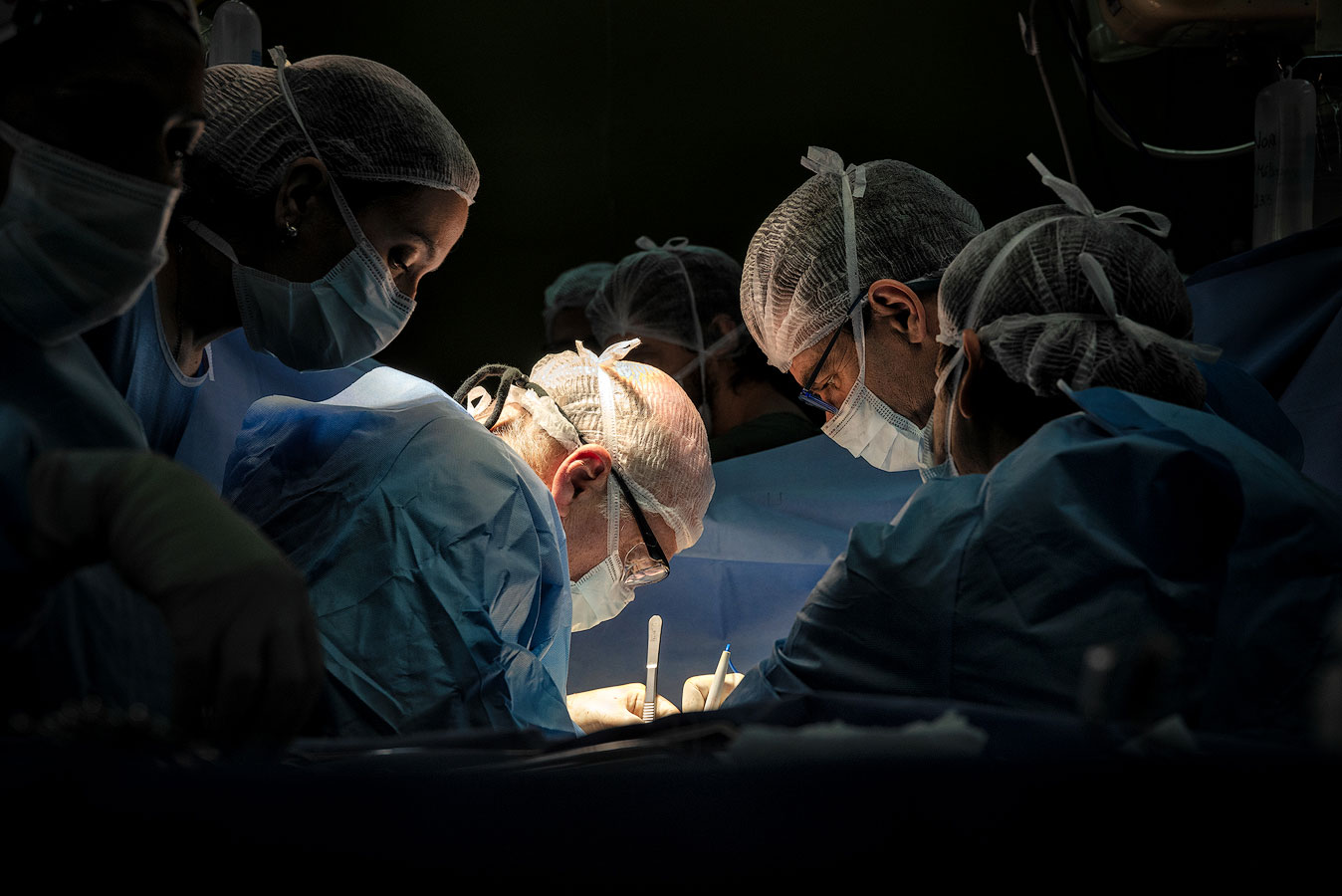 Surgeons performing a hepatic (liver) transplant in an operating theater.